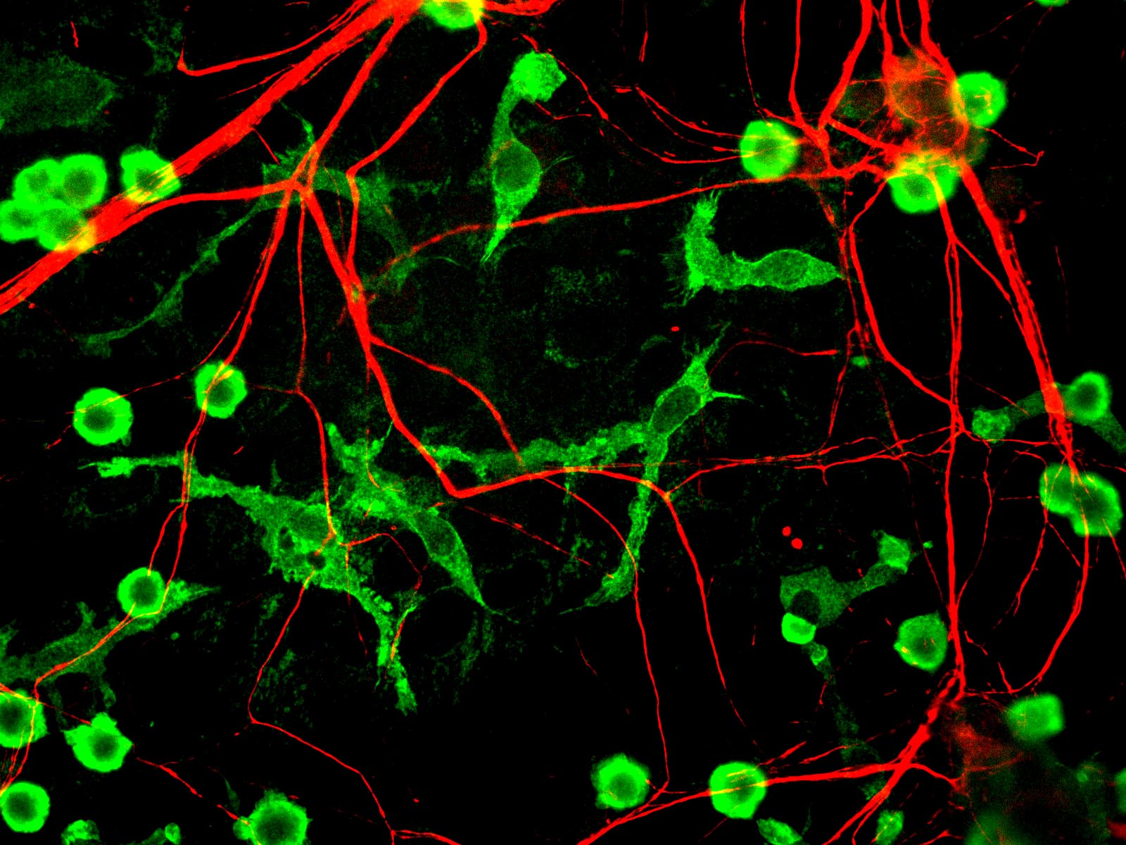 Microglia and Neurons. &copy; 2025 Gerry Shaw cc-by-sa.